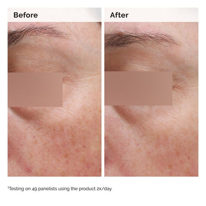 Niacinamide 5% Face and Body Emulsion - US 4160