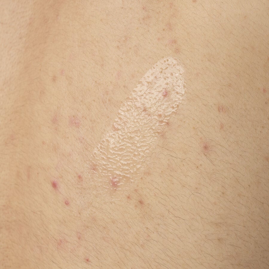 Salicylic Acid 0.5% Body Serum - US 4655